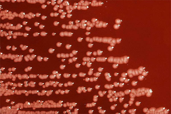 Колонии штамма бактерий Yersinia на поверхности агар-агара, фото фотография